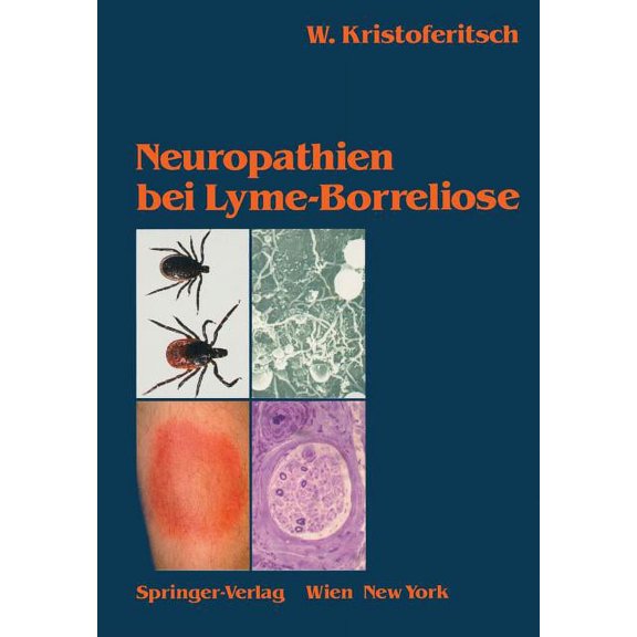 Neuropathien Bei Lyme-Borreliose, (Paperback)