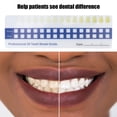 thumbnail image 3 of Teeth Color Chart, 5pcs Teeth Whitening Shade Guide Household Tooth Shade Chart Comparing Card Oral Care Supplies for Dentist, 3 of 9