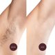 thumbnail image 5 of Tiras de cera Nad's Body para pieles sensibles con 28 tiras, 5 of 9