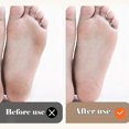 thumbnail image 4 of New Electric Callus Remover - Compact USB Rechargeable Foot File, Durable Design for Dead Skin & Callus Removal, Ideal Personal Care Gift, 4 of 10