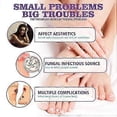 thumbnail image 3 of 1/2/3Pcs 100ML Medinail Fungus Repair Spray For Foot,Nail, Soft Nail, Yellow Hair Care, 3 of 5