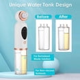 thumbnail image 3 of Limpiador de poros eléctrico con burbujas para eliminar puntos negros, succión al vacío para eliminar puntos negros y acné, dispositivo de belleza para el cuidado de la piel facial, 3 of 4