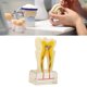 thumbnail image 4 of Modelo de Caries Dental Estudio Modelo de Dientes Estándar Demostración Patológico Educativo Herramientas de Enseñanza de Dientes 6 Veces Caries Modelo de Dientes Suministros ANGGREK  Otros, 4 of 8