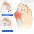 thumbnail image 2 of Claw Toe Corrector, Gel Bunion Correctors Foot Stretcher  For Athlete For Home, 2 of 7