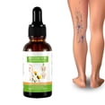 thumbnail image 1 of Aceite esencial para masaje de venas varicosas en las piernas, cuidado hidratante, solución calmante para el cuidado de las piernas para mejorar la circulación sanguínea, 1 of 7