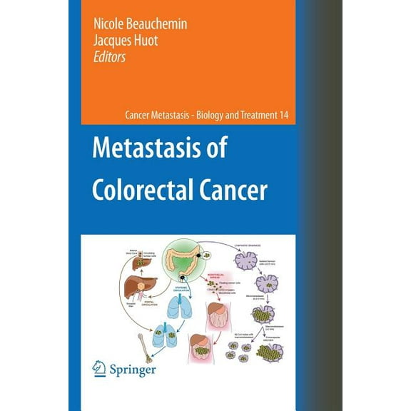 Cancer Metastasis - Biology and Treatmen Metastasis of Colorectal Cancer, Book 14, (Paperback)