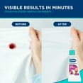 thumbnail image 6 of Carbona Stain Devils® #4 | Blood, Dairy & Ice Cream | Professional Strength Laundry Stain Remover | Multi-Fabric Cleaner | Safe On Skin & Washable Fabrics | 1.7 Fl Oz, 1 Pack, 6 of 9