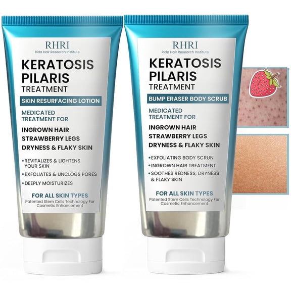 KP Bump Eraser Body Set Keratosis Pilaris Treatment  Keratosis Pilaris Lotion | Exfoliating Body Scrub