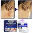 thumbnail image 5 of Crema para la picazón de la piel, 1/2 Uds., 30g, para manos, piernas, picazón y crema tópica, 5 of 5