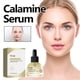 thumbnail image 1 of Xihbxyly Oferta del día Liquidación Suero de calamina Centella asiática fotosensible, hidrata, cierra los poros, aclara y blanquea la pie del rostro, 30 ml, 1 of 7