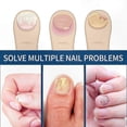 thumbnail image 2 of Fungal Nail Treatment Patches for Onychomycosis Repair, 2 of 5