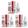 thumbnail image 1 of 15ml Fungi Nail Treatment Liquid Fast-Acting Nail Repair Strengthening Liquid Nails Care Supplies, 1 of 5