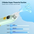 thumbnail image 4 of Cshidworld Nasal Aspirator for Baby, Electric Nose Aspirator for Toddlers, Waterproof Baby Nose Sucker with 3 Silicone Tips, 3 Adjustable Suction Level, Music and Light Soothing Function,Green, 4 of 8