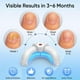 thumbnail image 2 of Nail Fungus Light Treatment 470nm Blue + 905nm Infrared Light for Fingernail & Toenail Repair, Home Use Onychomycosis Laser Therapy, 2 of 5