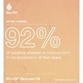 thumbnail image 2 of Aceite Corporal Bio-Oil Naranja 200 Ml Productos Skin Care Belleza, 2 of 7