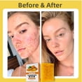 thumbnail image 4 of KINeSYS Pro Sport Bálsamo labial con manteca de karité SPF30 Cuidado labial hidratante de amplio espectro para actividades al aire libre Resistente al agua y protección UVA/UVB Acabado mate transparen, 4 of 5