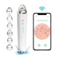thumbnail image 1 of Blackhead Remover with Camera, Vacuum Blackhead Suction Pore Cleaner with Microscope, 1 of 5