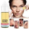 thumbnail image 2 of Laboratory Puncture Mass Solution And Keloid Removal B| Soothing Post Puncture For Puncture Mass And Keloid Removal | Post Puncture Solution For Ear And Nose Keloids Oil 15ml, 2 of 9