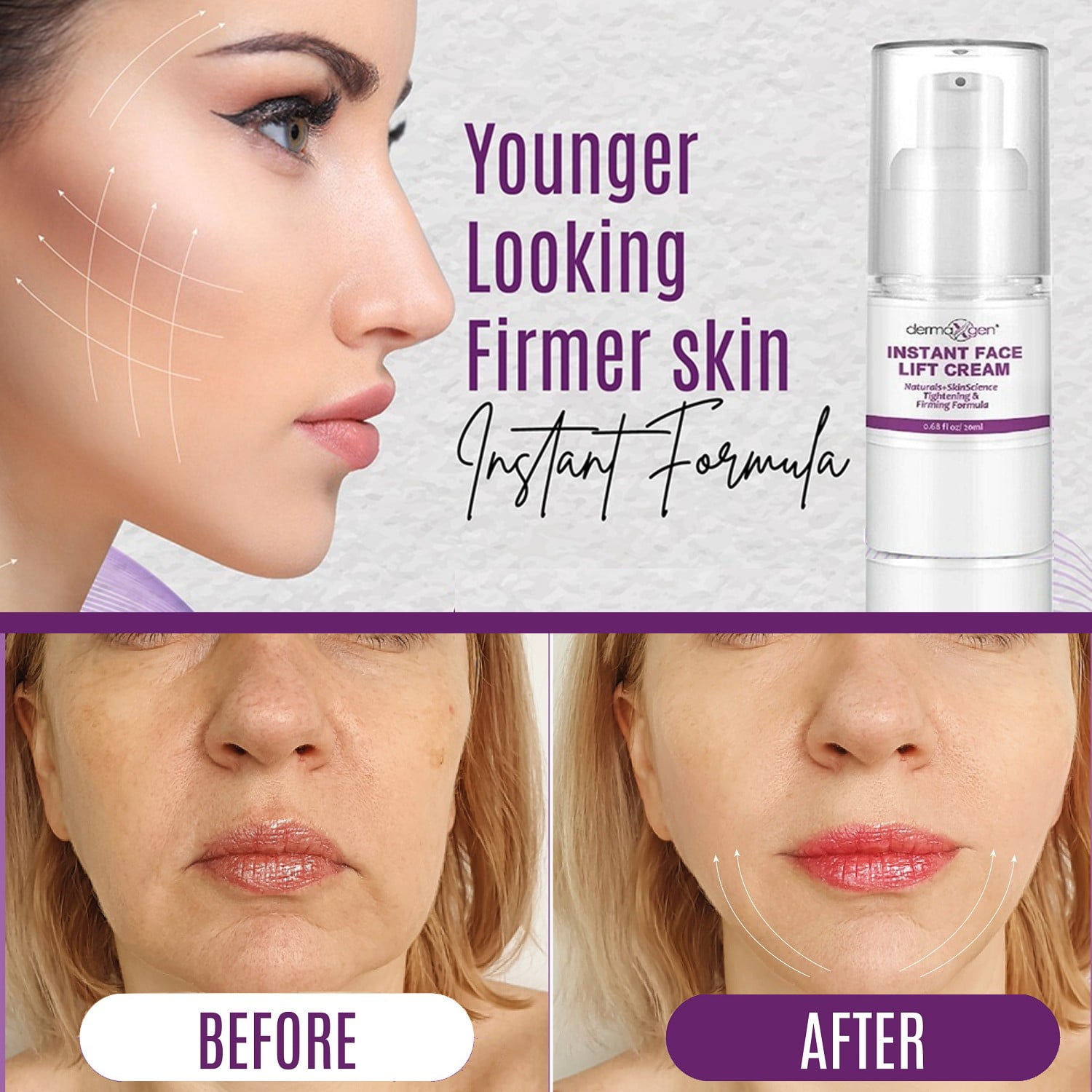 Dermaxgen INSTANT FACE LIFT - Anti-Aging, Lifting & Firming Cream for Loose Sagging Skin, Fine Lines, & Crow's Feet (INSTANT RESULTS) - 20 ML - Walmart.com