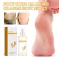 thumbnail image 4 of Spray de Naranja para Callos y Callos En Los Pies (30 Ml) | Ayuda con Callos Ásperos y Problemas de Piel | Ingredientes Naturales | Hidrata y Promueve La Salud de La Piel, 4 of 7