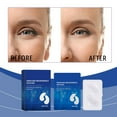 thumbnail image 5 of EYE Anti-Rides EYE Patch Microneedle Microneedle Anti-Rides Patch EYE Illumine la Peau Autour des Yeux Hydrate et Réduit Efficacement les Ridules 2 ml, 5 of 5