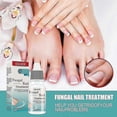 thumbnail image 5 of 1pc Fungal Nail Treatment Liquid Nail Repair Moisturizing Anti-bag Nursing Liqui, 5 of 5
