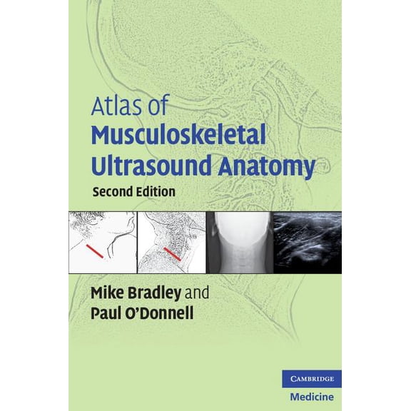 Atlas of Musculoskeletal Ultrasound Anatomy, (Paperback)