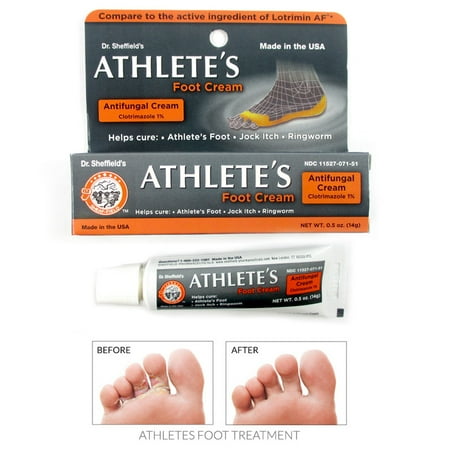 Athlete's Foot Antifungal Cream Treatment Jock Itch Ringworm Itching Anti (Best Antifungal Cream For Ringworm)