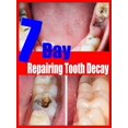 thumbnail image 2 of Reparación de caries dentales, reparación de todas las cavidades, 2 of 4