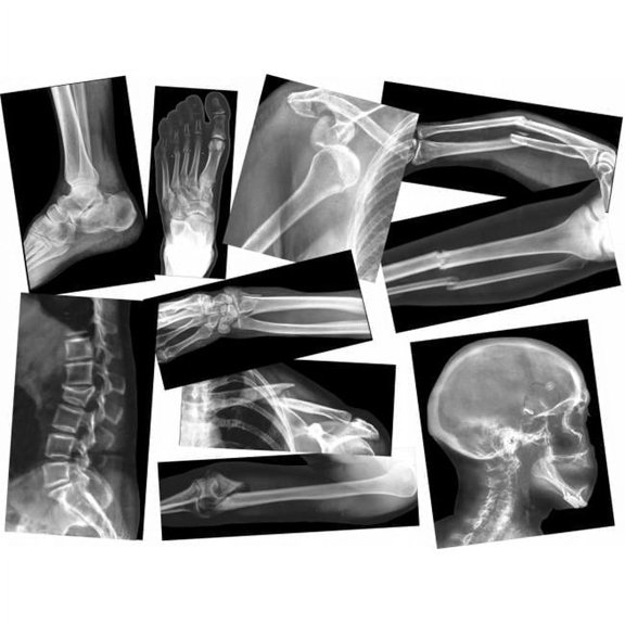 Roylco Broken Bones X-Rays 15 pcs