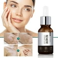 is gabapentin for swelling