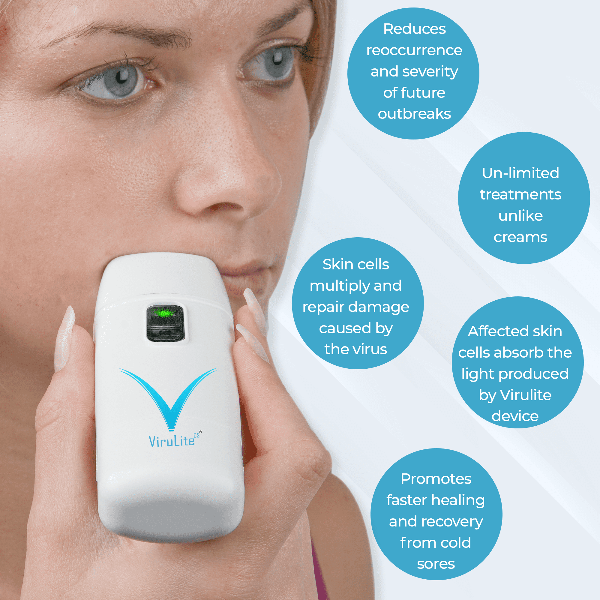 Virulite The Only FDA Approved Electronic Cold Sore Treatment Device