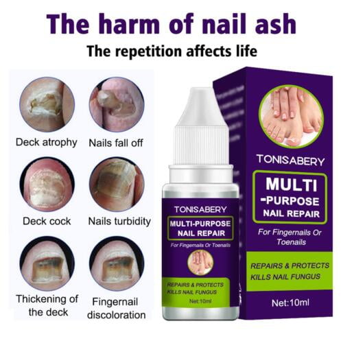 Fungal Nail Repair Essence Serum Care Treatment Foot Nail Fungus - Main Image