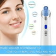 thumbnail image 2 of Soidarity Extractor de vacío de espinillas recargable por USB eléctrico, herramienta de eliminación de acné facial, suministros personales Cuerpo del baño Rosa, 2 of 6