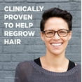 Equate Minoxidil Topical Solution, 2 Percent, Hair Regrowth Treatment