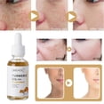 thumbnail image 2 of 2xAceite Esencial De 30ml Reduce Las Líneas Finas Para Masajes Mujeres Hombres Unisex Salvador Dali Aceite de cúrcuma, 2 of 10