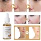 thumbnail image 2 of Aceite de ,Aceite de antiarrugas Hidratar,Aceite Esencial de 30ml Corporal,Extracto de  Care cuentagotas cubierta,Blanqueamiento de relajación Yinane Aceite de cúrcuma, 2 of 8