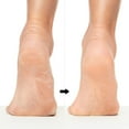thumbnail image 2 of Revlon Callus Remover, Foot File with No-Mess Cover, Gently Exfoliates and Smooths Feet, 2 of 7