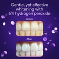 thumbnail image 2 of Kit de tiras blanqueadoras Burst para dientes sensibles, 10 tratamientos, 2 of 6