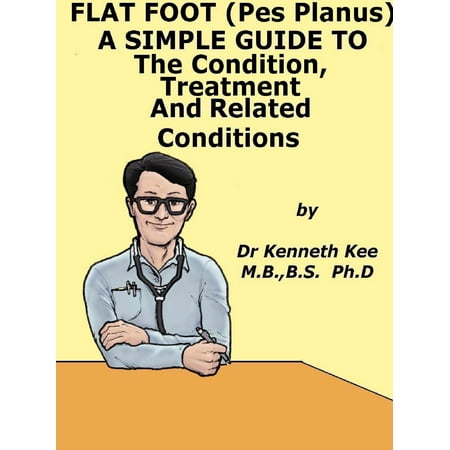Flat Foot (Pes Planus), A Simple Guide to The Condition, Treatment And Related Conditions -