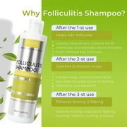 Anti Fungal Folliculitis Shampoo, Seborrheic Dermatitis Shampoo, Anti Dandruff Shampoo, Folliculitis Treatment, Dandruff Treatment, Scalp Psoriasis Treatment, Relieve From Itchy & Dry Scalp