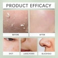 thumbnail image 2 of Purifying Exfoliating Gel for Face and Body Cleansing Scrub, 2 of 5
