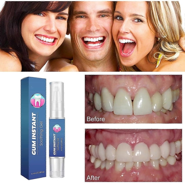 Gum Therapy Gel, Gum Therapy Gel Pen, Safe And Effective Teeth Whitening Gel, Nature Teeth Whitening Essence Pen