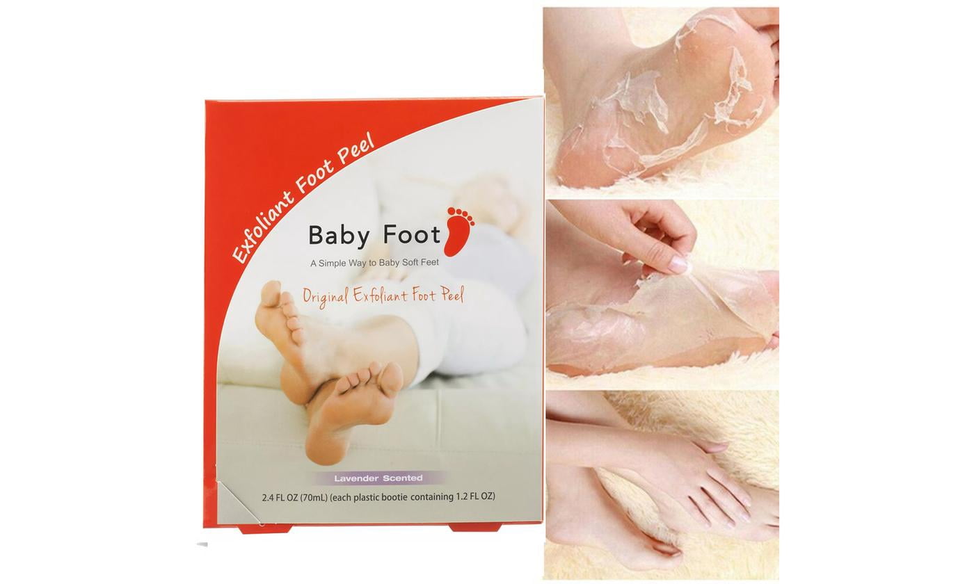 baby foot peel walmart canada