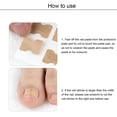 thumbnail image 2 of Corrector de uñas encarnadas, tira de uñas, 10 Uds., herramientas de cuidado de pedicura (marfil) Tmvgtek Cuidado Belleza, 2 of 4