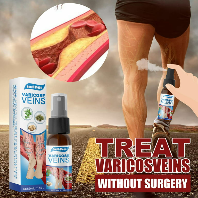 Treatment for Spider Veins & Varicose Veins - Holy Cross Medical Center