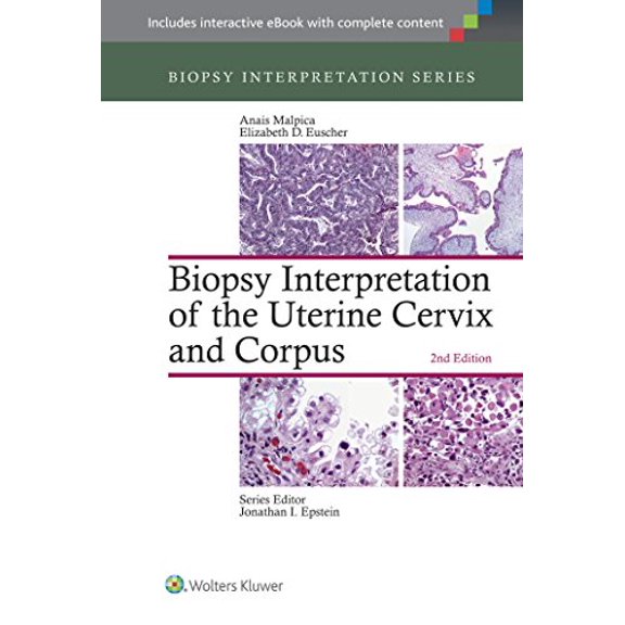 Pre-Owned Biopsy Interpretation of the Uterine Cervix and Corpus (Hardcover) by Anais Malpica, Elizabeth D Euscher