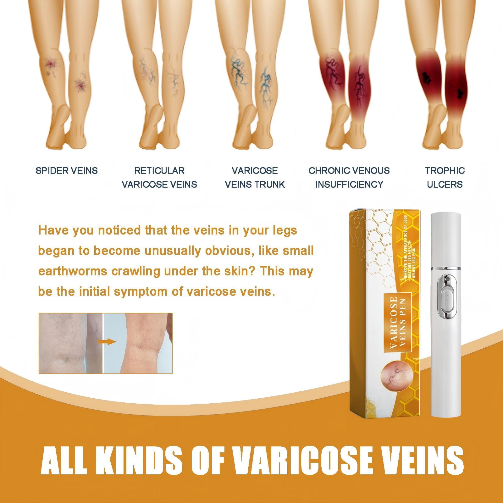Alvantor Leg Massager for Pain Relief, Mini Muscle-Soothing Massage Pen