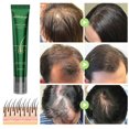 thumbnail image 5 of Hair Care Oil Natural Hair Growth Serum Improves Scalp Health for Men Women, 5 of 5