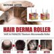 thumbnail image 3 of Hair Derma Roller 600 Titanium Micro Needles Roller Hair Regeneration Growth Scalp Massager 26-27s, 3 of 5